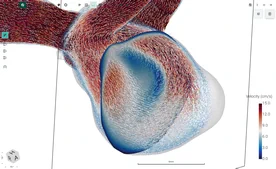 Blood Flow CFD by FlowLens