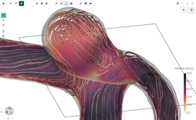 Blood Flow CFD by FlowLens