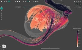 Blood Flow CFD by FlowLens