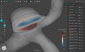 Blood Flow CFD by FlowLens