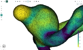 Blood Flow CFD by FlowLens