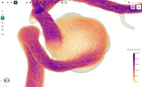 Blood Flow CFD by FlowLens