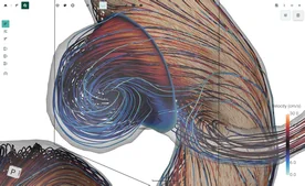 Blood Flow CFD by FlowLens