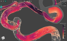 Blood Flow CFD by FlowLens