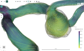 Blood Flow CFD by FlowLens