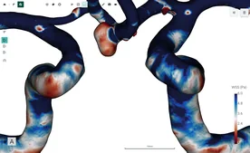 Blood Flow CFD by FlowLens