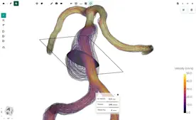 Blood Flow CFD by FlowLens