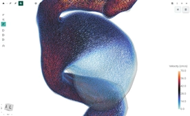 Blood Flow CFD by FlowLens