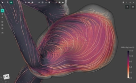 Blood Flow CFD by FlowLens