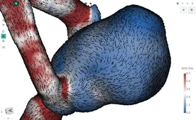 Blood Flow CFD by FlowLens