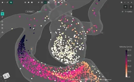 Blood Flow CFD by FlowLens