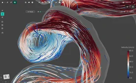 Blood Flow CFD by FlowLens